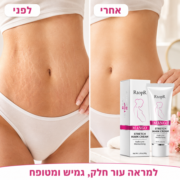 קרם הפלא מסייע במניעת סימני מתיחה